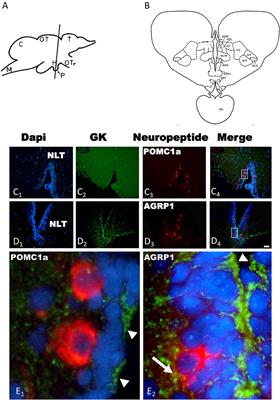 Sensing Glucose in the Central Melanocortin Circuits of Rainbow Trout: A Morphological Study